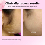 Cyperus Rotundus Oil for Hair Reduction Natural Permanent Hair Reduction