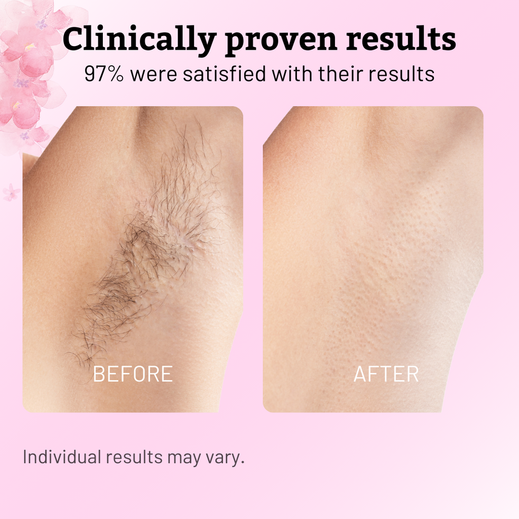 Cyperus Rotundus Oil for Hair Reduction Natural Permanent Hair Reduction